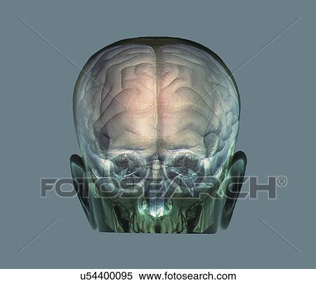 Human head, 3D CT and MRI scans View Large Illustration Stock Illustration - Human head, 3D CT and MRI scans. Fotosearch