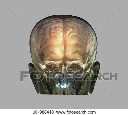 Stock Illustration - Human head, 3D CT and MRI scans. Fotosearch