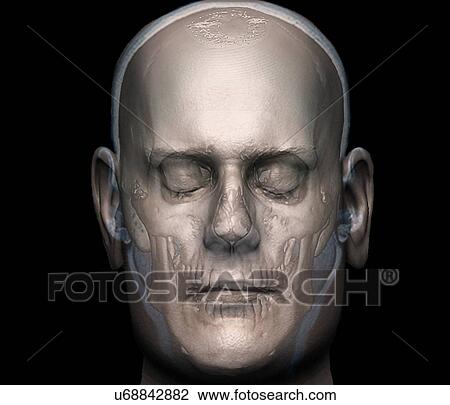 Human head, 3D CT scan View Large Illustration Drawing - Human head, 3D CT scan. Fotosearch