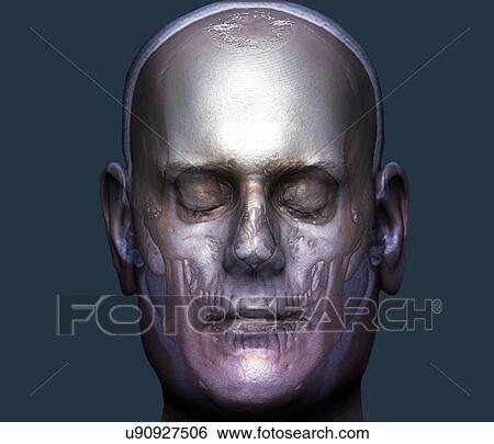 Human head, 3D CT scan View Large Illustration Stock Illustration - Human head, 3D CT scan. Fotosearch
