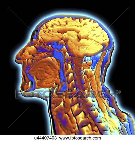 Human head, MRI View Large Illustration Drawing - Human head, MRI. Fotosearch