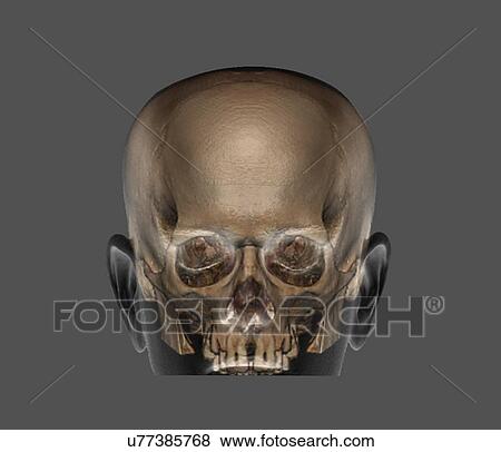 Human skull, 3D CT scan View Large Illustration Stock Illustration - Human skull, 3D CT scan. Fotosearch