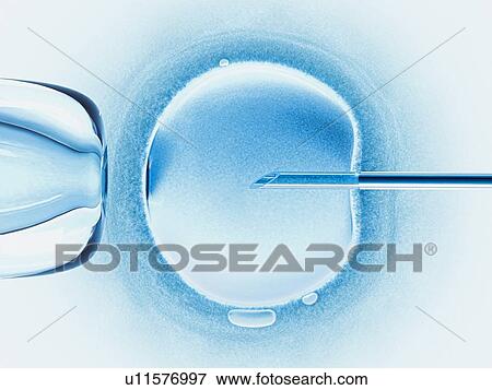 In vitro fertilisation, artwork View Large Illustration Stock Illustration - In vitro fertilisation, artwork. Fotosearch