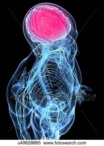 Stock Illustration - Inflamed brain, conceptual artwork. Fotosearch