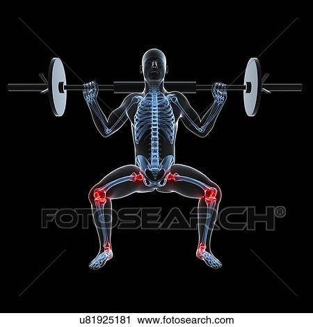 Clip Art - Joint pain, conceptual artwork. Fotosearch