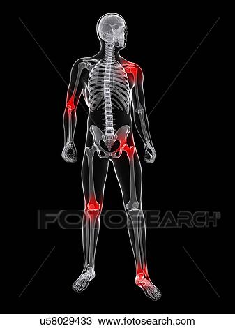 Joint pain, conceptual artwork View Large Illustration Drawing - Joint pain, conceptual artwork. Fotosearch