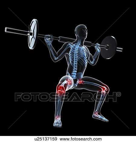 Stock Illustration - Joint pain, conceptual artwork. Fotosearch
