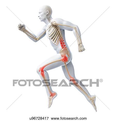 Stock Illustration - Joint pain, conceptual artwork. Fotosearch
