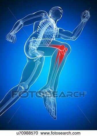 Clipart - Knee pain, conceptual artwork. Fotosearch