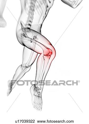 Knee pain, conceptual artwork View Large Illustration Drawing - Knee pain, conceptual artwork. Fotosearch