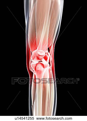 Stock Illustration - Knee pain, conceptual artwork. Fotosearch