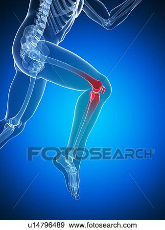 Knee pain, conceptual artwork View Large Illustration Stock Illustration - Knee pain, conceptual artwork. Fotosearch