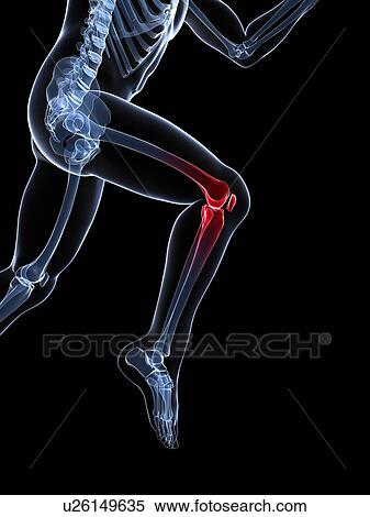 Knee pain, conceptual artwork View Large Illustration Stock Illustration - Knee pain, conceptual artwork. Fotosearch