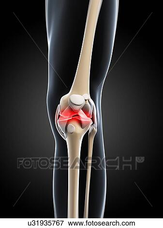 Knee pain, conceptual artwork View Large Illustration Stock Illustration - Knee pain, conceptual artwork. Fotosearch