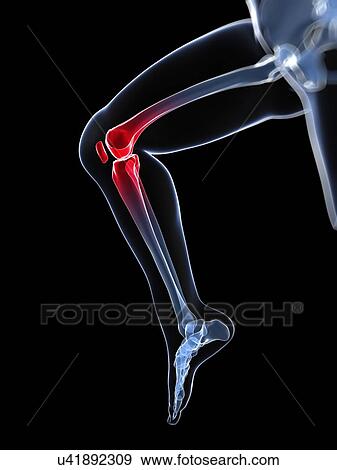 Knee pain, conceptual artwork View Large Illustration Stock Illustration - Knee pain, conceptual artwork. Fotosearch