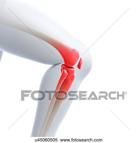 Knee pain, conceptual artwork View Large Illustration Stock Illustration - Knee pain, conceptual artwork. Fotosearch