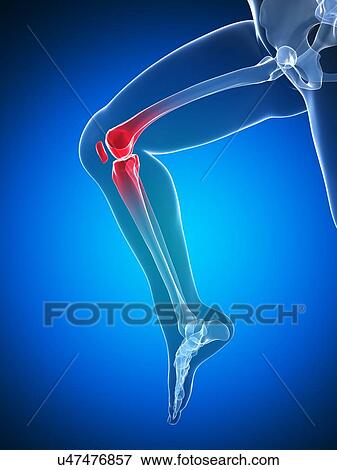 Knee pain, conceptual artwork View Large Illustration Stock Illustration - Knee pain, conceptual artwork. Fotosearch