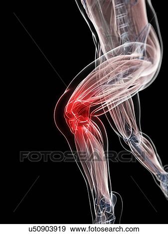 Stock Illustration - Knee pain, conceptual artwork. Fotosearch