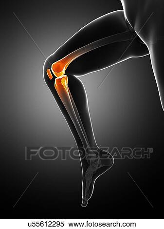Stock Illustration - Knee pain, conceptual artwork. Fotosearch