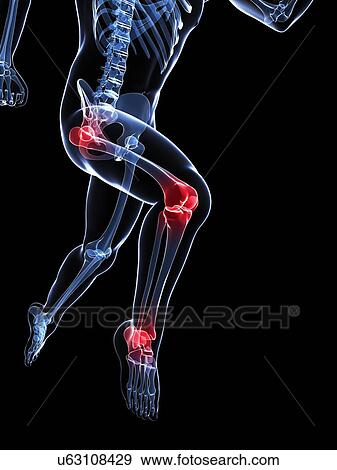Knee pain, conceptual artwork View Large Illustration Stock Illustration - Knee pain, conceptual artwork. Fotosearch
