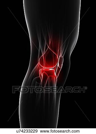 Knee pain, conceptual artwork View Large Illustration Stock Illustration - Knee pain, conceptual artwork. Fotosearch