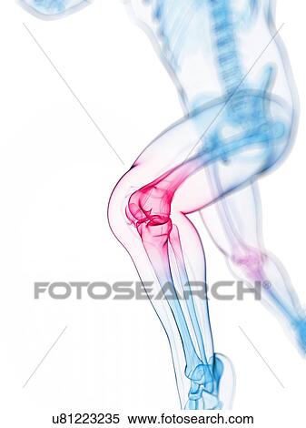 Knee pain, conceptual artwork View Large Illustration Stock Illustration - Knee pain, conceptual artwork. Fotosearch