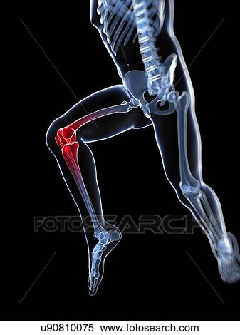 Stock Illustration - Knee pain, conceptual artwork. Fotosearch