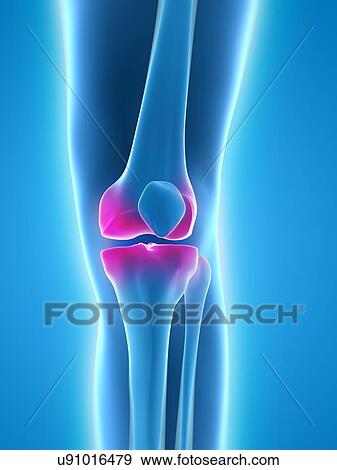 Knee pain, conceptual artwork View Large Illustration Stock Illustration - Knee pain, conceptual artwork. Fotosearch