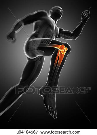 Knee pain, conceptual artwork View Large Illustration Stock Illustration - Knee pain, conceptual artwork. Fotosearch