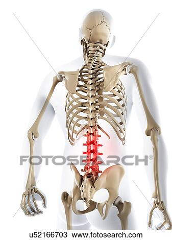 Lower back pain, conceptual artwork View Large Illustration Drawing - Lower back pain, conceptual artwork. Fotosearch