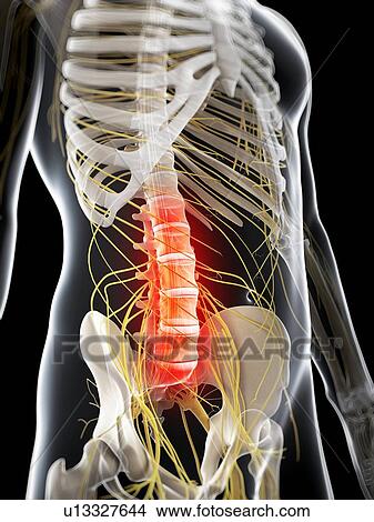 Lower back pain, conceptual artwork View Large Illustration Stock Illustration - Lower back pain, conceptual artwork. Fotosearch
