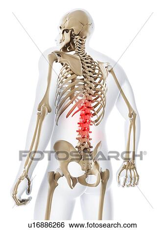Lower back pain, conceptual artwork View Large Illustration Stock Illustration - Lower back pain, conceptual artwork. Fotosearch