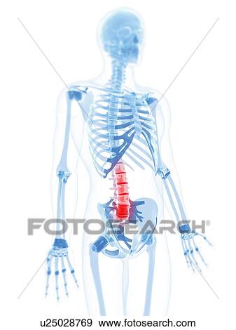 Lower back pain, conceptual artwork View Large Illustration Stock Illustration - Lower back pain, conceptual artwork. Fotosearch