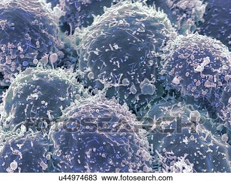 Drawing - Lung cancer cells, SEM. Fotosearch