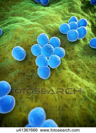 Stock Illustration - MRSA bacteria, artwork. Fotosearch