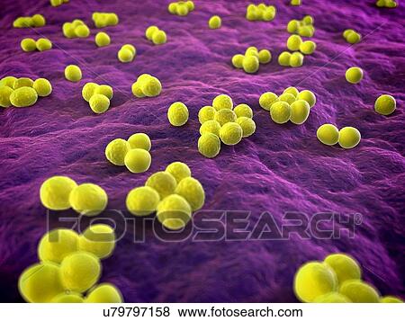 Stock Illustration - MRSA bacteria, artwork. Fotosearch