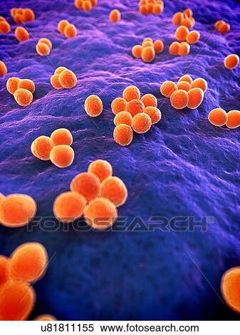 Stock Illustration - MRSA bacteria, artwork. Fotosearch