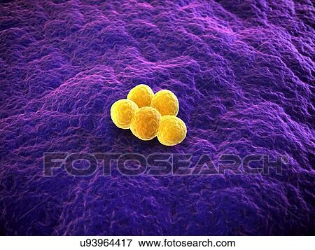 Stock Illustration - MRSA bacteria, artwork. Fotosearch