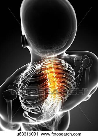 Neck pain, conceptual artwork View Large Illustration Clip Art - Neck pain, conceptual artwork. Fotosearch