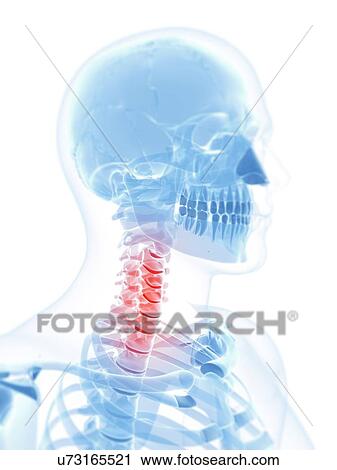 Neck pain, conceptual artwork View Large Illustration Clip Art - Neck pain, conceptual artwork. Fotosearch