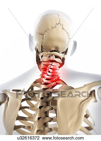 Neck pain, conceptual artwork View Large Illustration Drawing - Neck pain, conceptual artwork. Fotosearch