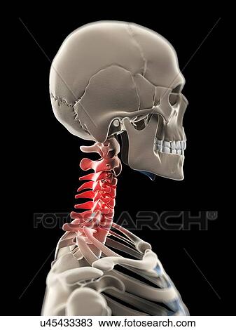Neck pain, conceptual artwork View Large Illustration Drawing - Neck pain, conceptual artwork. Fotosearch