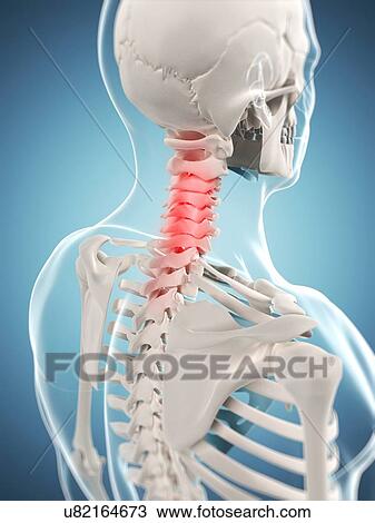 Neck pain, conceptual artwork View Large Illustration Drawing - Neck pain, conceptual artwork. Fotosearch
