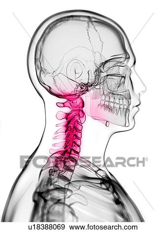 Neck pain, conceptual artwork View Large Illustration Stock Illustration - Neck pain, conceptual artwork. Fotosearch