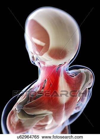 Stock Illustration - Neck pain, conceptual artwork. Fotosearch