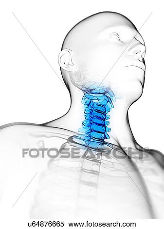 Neck pain, conceptual artwork View Large Illustration Stock Illustration - Neck pain, conceptual artwork. Fotosearch