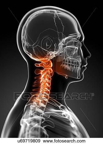 Neck pain, conceptual artwork View Large Illustration Stock Illustration - Neck pain, conceptual artwork. Fotosearch
