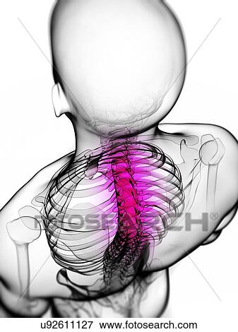 Neck pain, conceptual artwork View Large Illustration Stock Illustration - Neck pain, conceptual artwork. Fotosearch