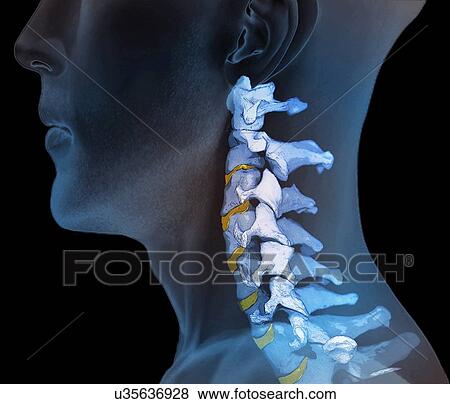 Normal neck bones, 3D CT scan View Large Illustration Stock Illustration - Normal neck bones, 3D CT scan. Fotosearch