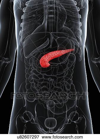 Pancreatitis, conceptual artwork View Large Illustration Stock Illustration - Pancreatitis, conceptual artwork. Fotosearch